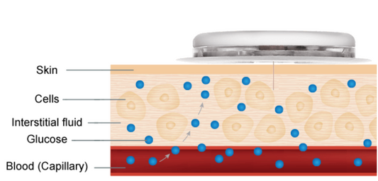 CGM Insertion Method